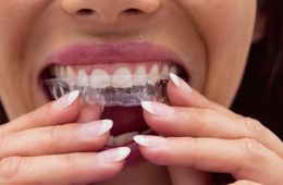 Keep Your Orthodontic Results Intact with Retainer Care Designed for Al Ain Patients