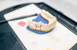 Affordable Dental Crowns in Al Ain Treatment Options and Benefits